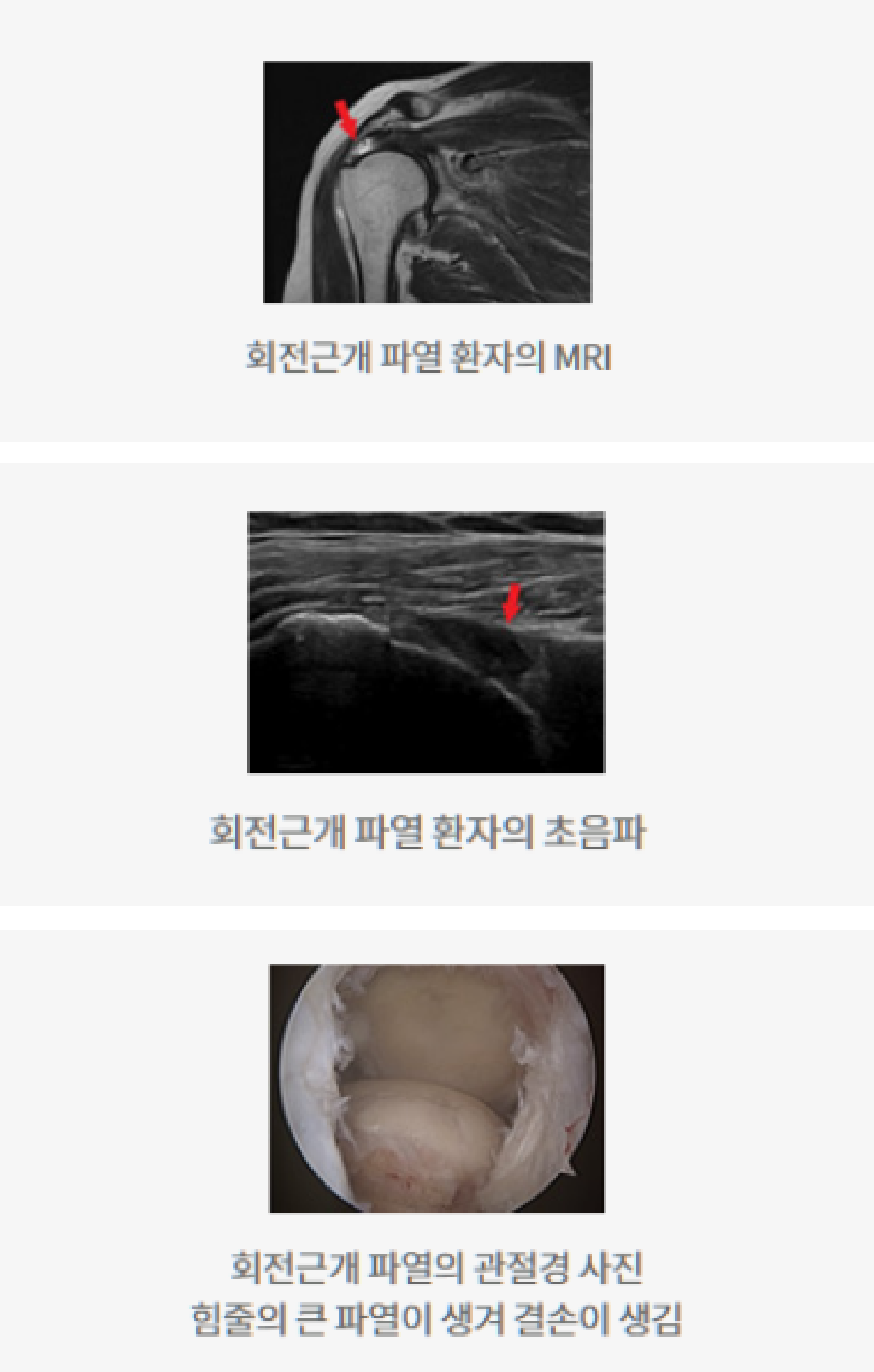 의료정보